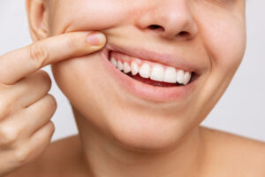 Gum health. Cropped shot of a young woman showing healthy gums. Dental care, dentistry concept