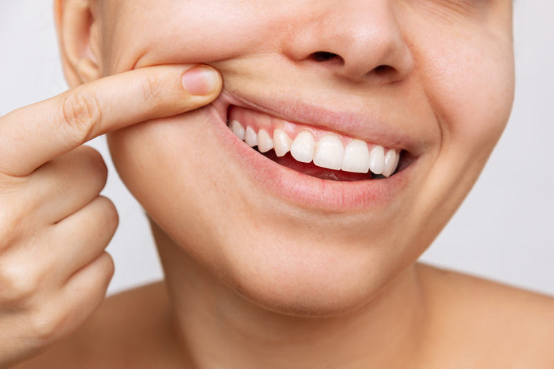 Gum health. Cropped shot of a young woman showing healthy gums. Dental care, dentistry concept