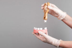 Gloved hands holding a dental model and using wooden forceps to demonstrate tooth extraction.